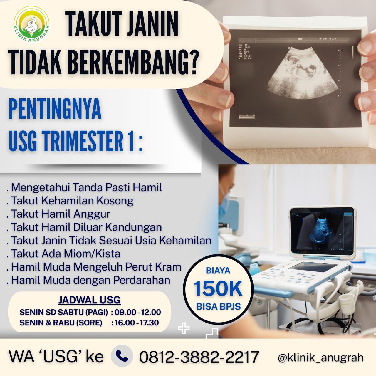 USG1