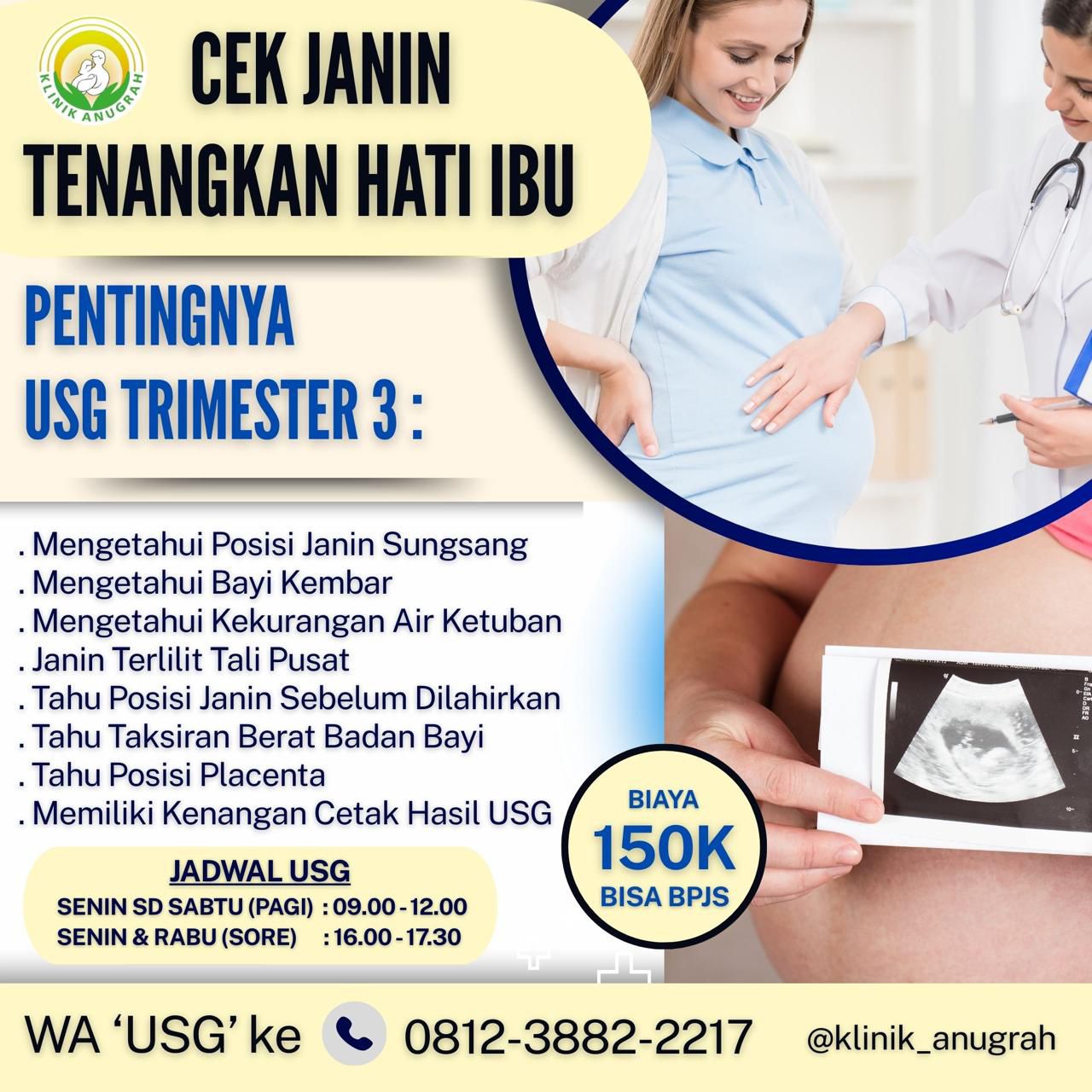 USG3